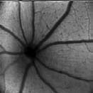 gfp mouse retina